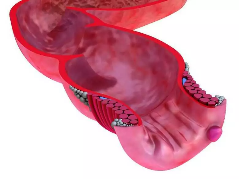 Thrombus formation and development - deep vein thrombosis